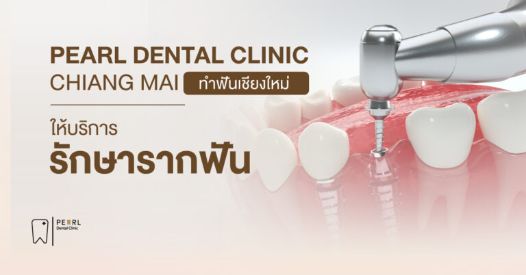 Pearl Dental Clinic Chiang Mai ทำฟันเชียงใหม่ ให้บริการ รักษารากฟัน