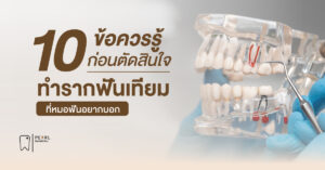 10 ข้อควรรู้ก่อนตัดสินใจทำ รากฟันเทียม ที่หมอฟันอยากบอก