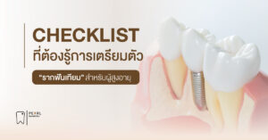 Checklist ที่ต้องรู้การเตรียมตัวก่อนทำรากเทียม