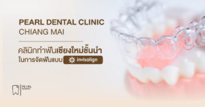 PEARL DENTAL CLINIC ทำฟันเชียงใหม่ชั้นนำในการจัดฟันแบบ INVISALIGN