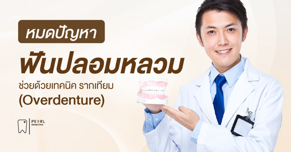 หมดปัญหาฟันปลอมหลวมช่วยเทคนิครากเทียม (Overdenture)