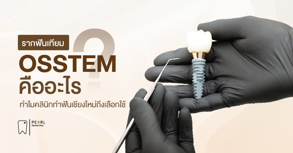 รากฟันเทียม Osstem คืออะไร ทำไมคลินิกทำฟันเชียงใหม่ถึงเลือกใช้