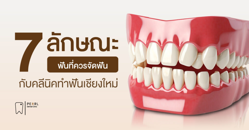 7 ลักษณะฟันที่ควรจัดฟันกับคลนิคทำฟันเชียงใหม่
