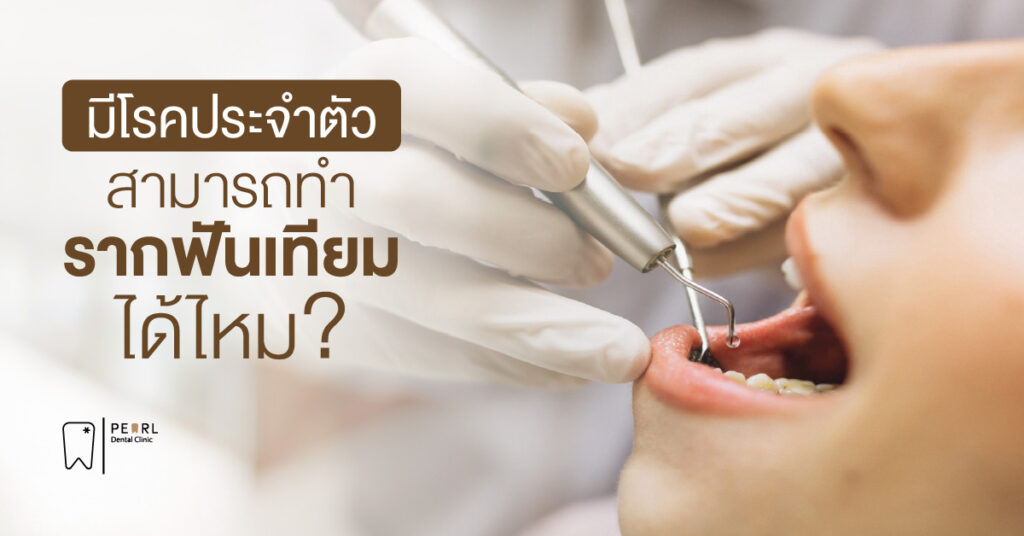 มีโรคประจำตัว สามารถทำรากฟันเทียมได้ไหม
