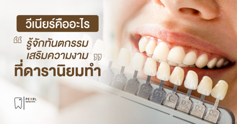 วีเนียร์คืออะไร รู้จักทันตกรรมเสริมความงามที่ดารานิยมทำ