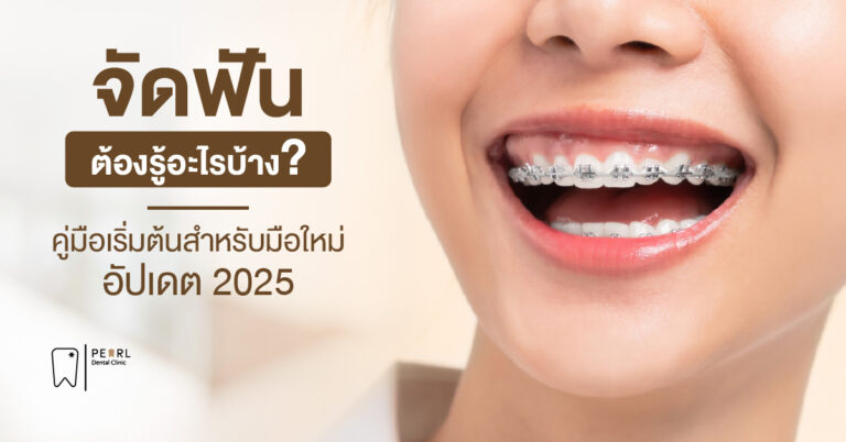 จัดฟันต้องรู้อะไรบ้าง คู่มือเริ่มต้นสำหรับมือใหม่ [อัปเดต 2025]