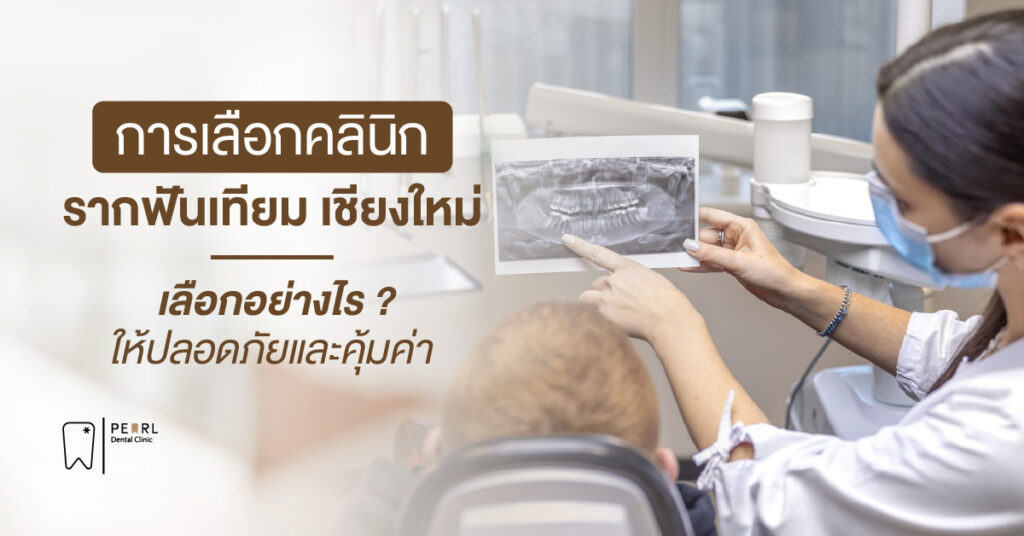 การเลือกคลินิกรากฟันเทียม เชียงใหม่ เลือกอย่างไรให้ปลอดภัยและคุ้มค่า