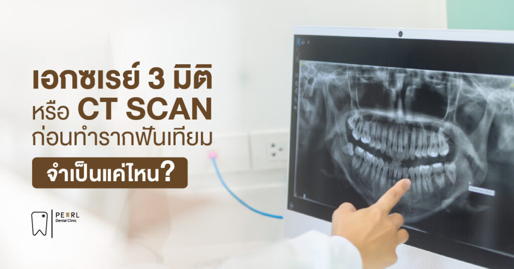 เอกซเรย์ 3 มิติ หรือ CT SCAN ก่อนทำรากฟันเทียม จำเป็นแค่ไหน