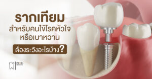 รากเทียมสำหรับคนไข้โรคหัวใจ หรือเบาหวาน ต้องระวังอะไรบ้าง