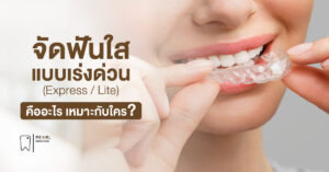 จัดฟันใสแบบเร่งด่วน (Express / Lite) คืออะไร เหมาะกับใคร